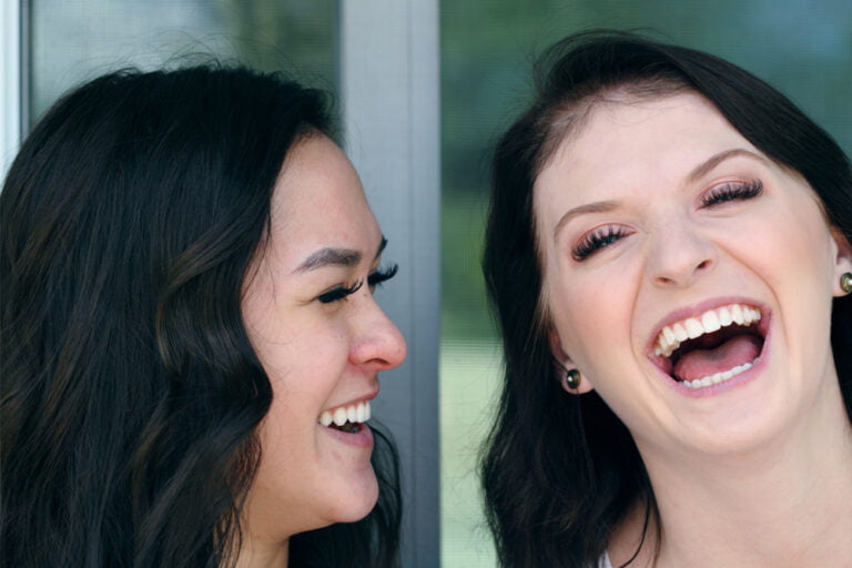 A Natural Look of Composite Fillings - Forest Ridge Dental in Cameron Park