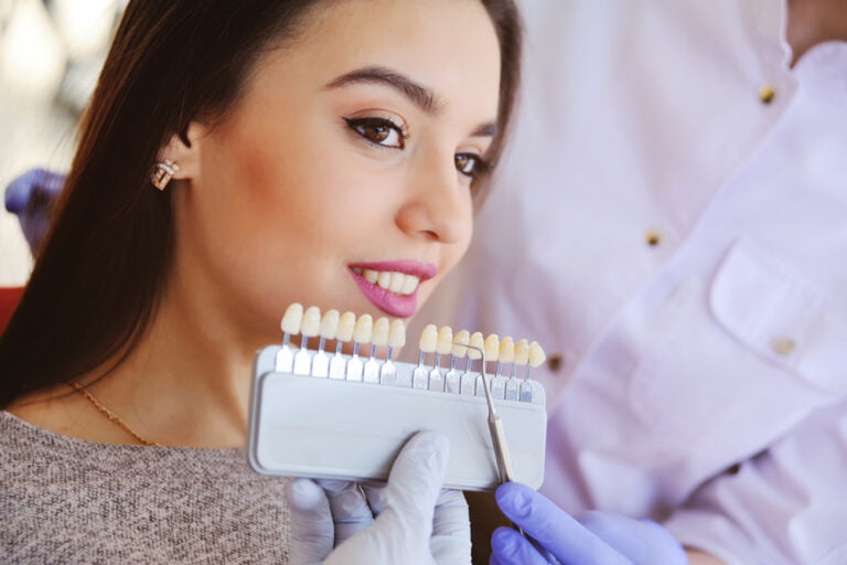 Top 3 Reasons People Choose Veneers