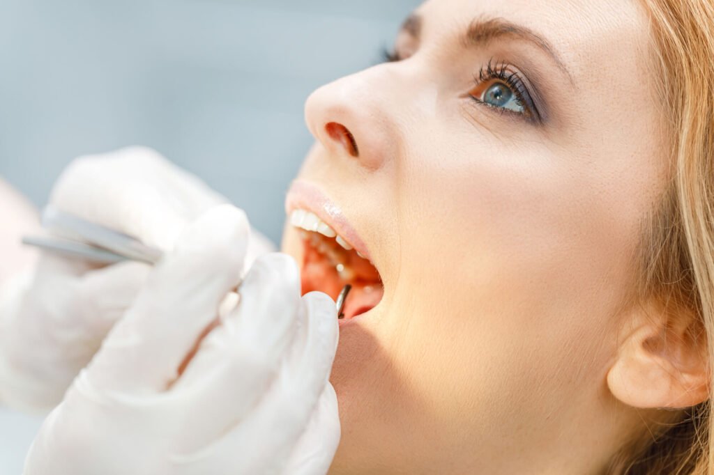 dentist in Cameron Park checking a patient's teeth