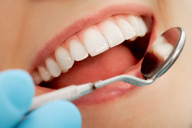 How Often Should I Get Teeth Whitened?