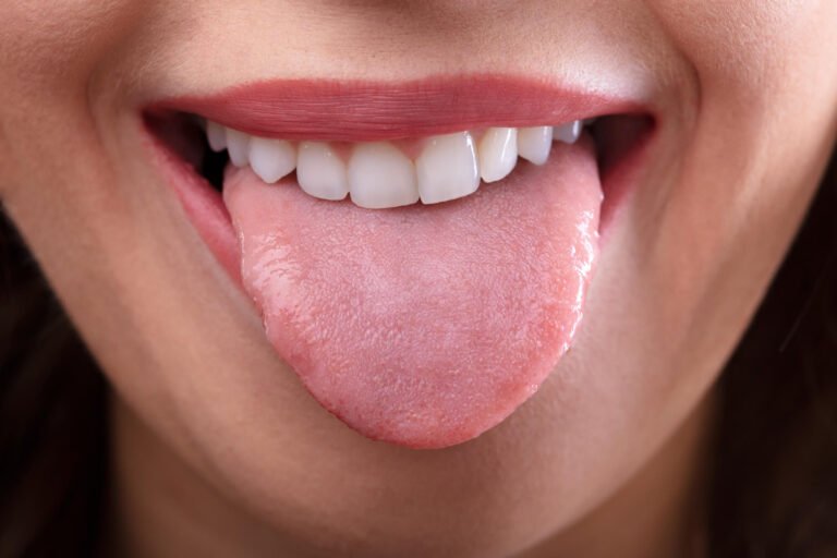 What Does Your Tongue Say About Your Health?
