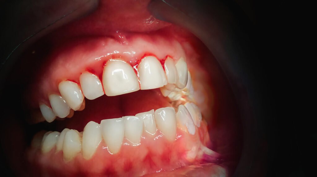 Shingle Springs Family Dentist dental checkups