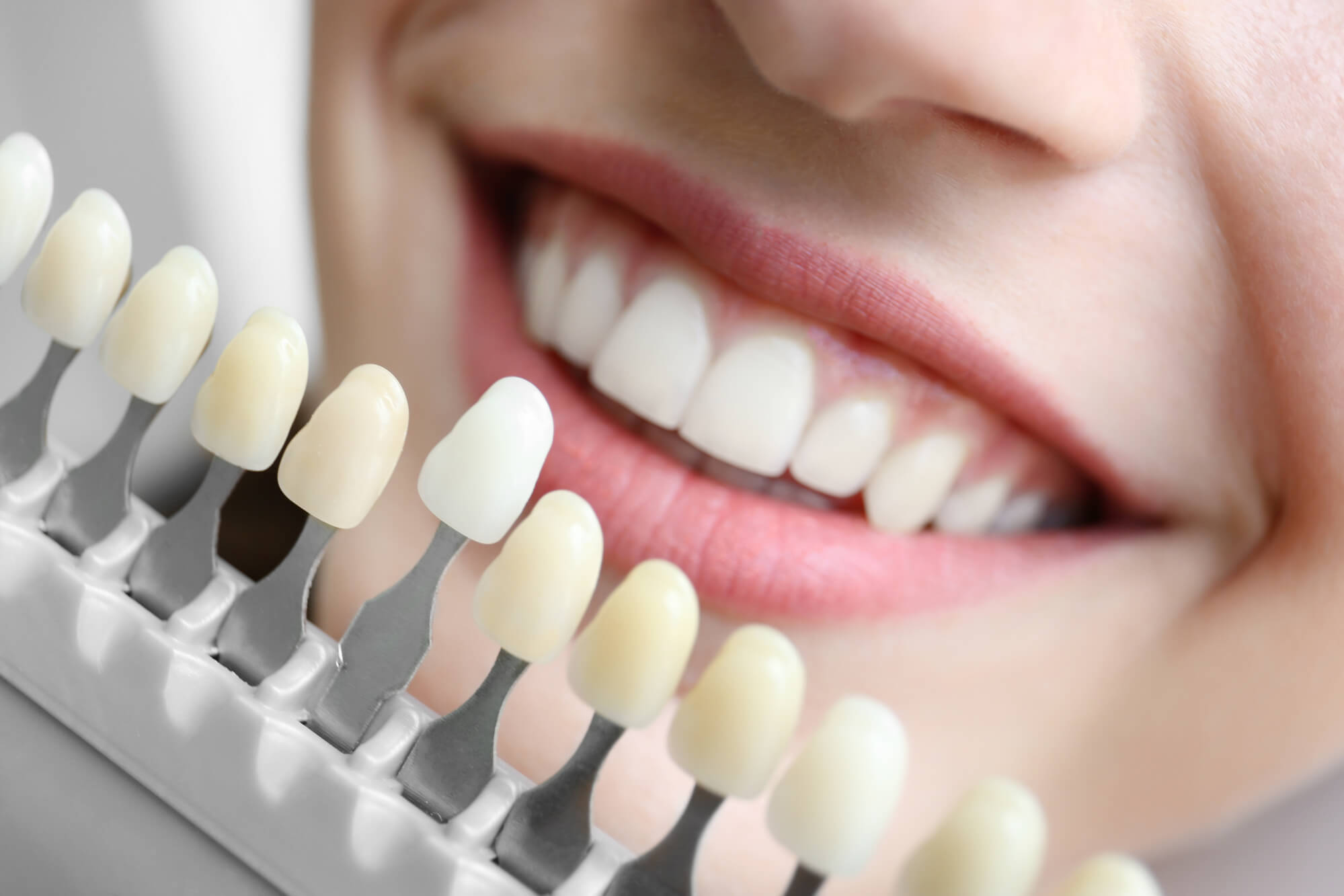 Woman at Cameron Park Cosmetic Dentistry