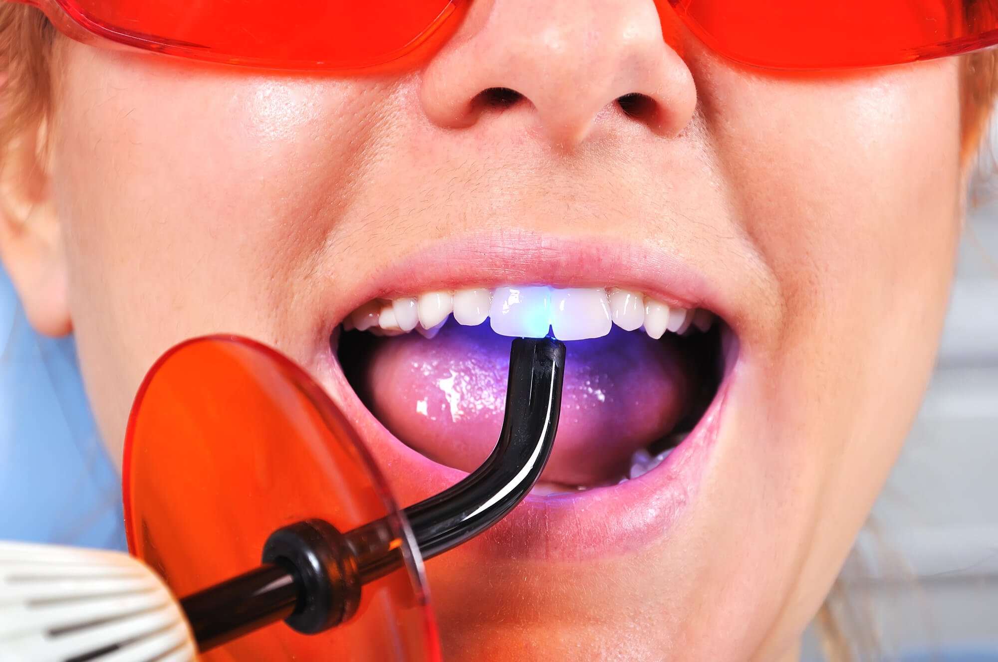 a dentist performing in-house Teeth Whitening in Cameron Park