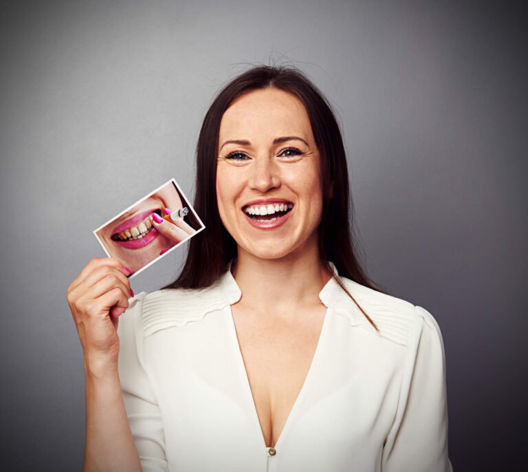 In-Office vs. Take-Home Professional Teeth Whitening - Forest Ridge Dental Group