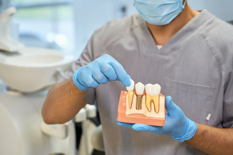 Dental Implants: Enjoy Your Every Bite
